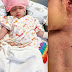 "Sangat jarang berlaku" - Anak kedua Amar Baharin, Amyra Rosli dijangkiti Kawasaki
