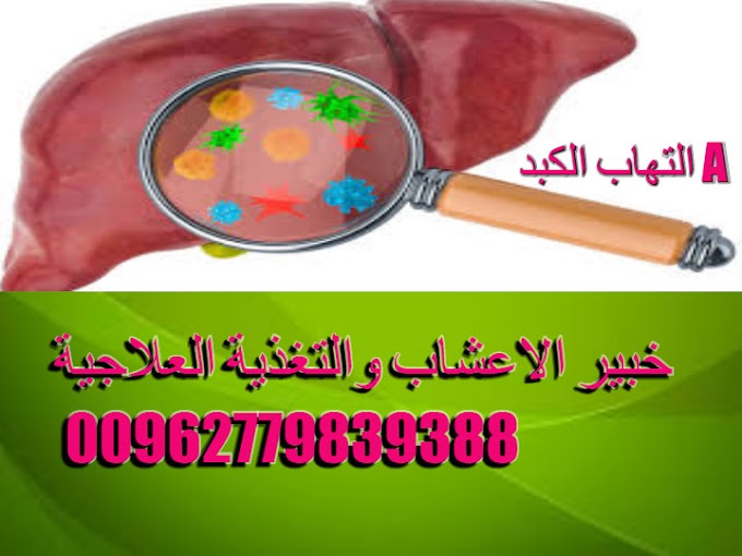 علاج فيروس وتليف الكبد بالاعشاب خبير الاعشاب   والتغذية العلاجية بالاعشاب الطبية   00962779839388