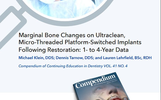 PDF: Marginal Bone Changes on Ultraclean, Micro-Threaded Platform-Switched Implants Following Restoration: 1- to 4-Year Data