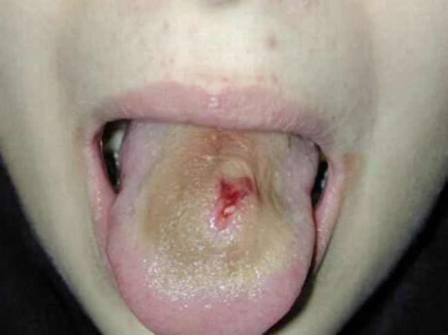 Piercings e Alargadores