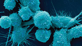 Human Cancer Cells