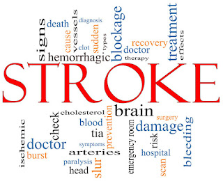 Kumpulan Cara Mengobati Penyakit Stroke
