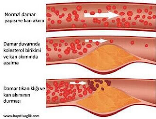 kolesterolün damarlara etkisi