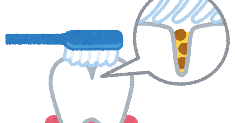 歯の溝の汚れのイラスト かわいいフリー素材集 いらすとや 歯の溝の汚れのイラスト かわいいフリー素材集 いらすとや