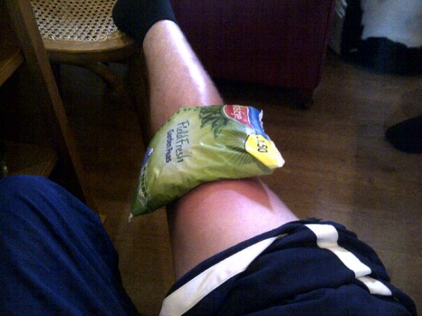 Icing our knees with Birds Eye Peas