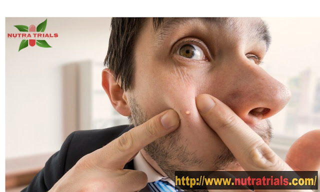 http://www.nutratrials.com/acne-causes-and-treatment-options-to-know/