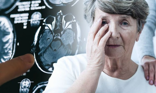 Dementia in Alzheimer's disease