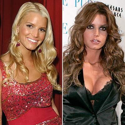 Jessica Simpson Plastic Surgery