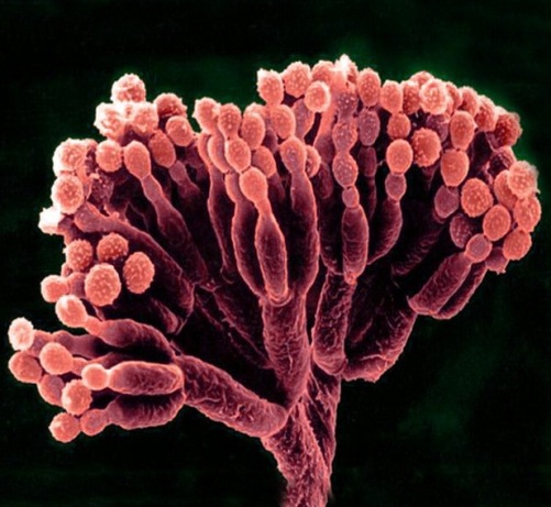 Penicillium spp Fungi Ciri ciri Reproduksi Contoh 