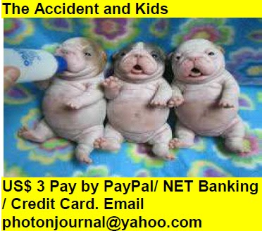  The Accident and Kids Book Store Yale University Book Fair Amazon Books eBay Book  Book Store Book Fair Book Exhibition Sell your Book Book Copyright Book Royalty Book ISBN Book Barcode How to Self Book 