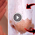 Massage Baking Soda Onto Your Nose Twice A Week – Watch What Happens To Your Pores