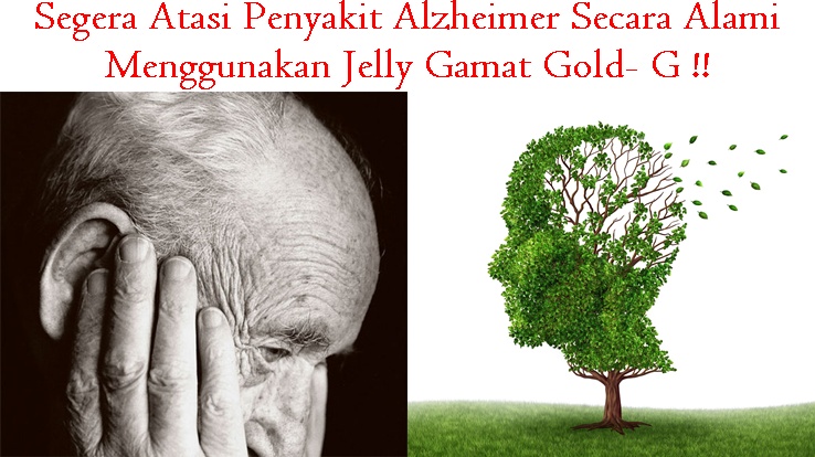 Obat Tradisional Tuntaskan Alzheimer