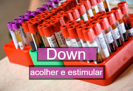 Teste detecta síndrome de Down no feto com 99,9% de precisão