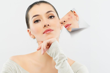Acne Scar Removal And Medical Insurance 