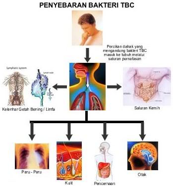 Disease in our Body PENYEBAB dan CARA PENULARAN PENYAKIT TBC