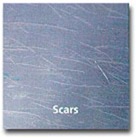 scars