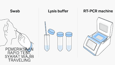 Hal yang dilakukan saat Pemeriksaan Rapid Test Sebagai syarat Traveling 