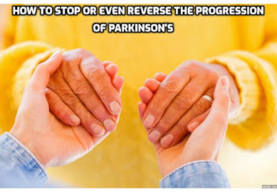 When treating Parkinson’s disease naturally, the most important thing is to boost your brain’s dopamine production. You can do that using the simple steps to stop or even reverse the progression of Parkinson’s You can do this by finding out more about the Parkinson’s Protocol Program created by naturopath and health researcher, Jodi Knapp, to help you diagnose and treat Parkinson’s naturally and permanently