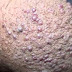 Kumpulan Obat Penyakit Kondiloma thumbnail