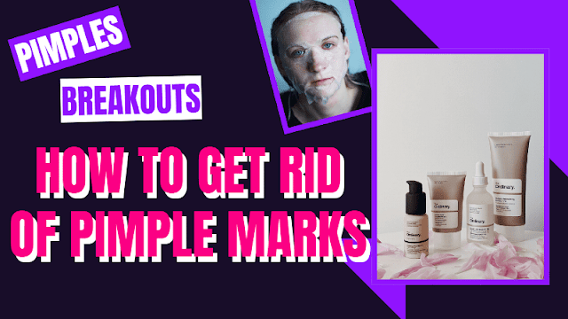 How To Get Rid Of Pimple Marks