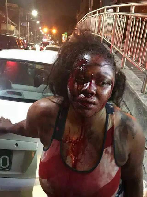  Young lady brutally beaten by her boyfriend in South Korea few week after their engagement (photos)