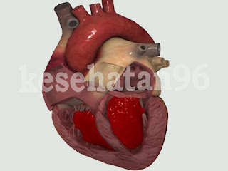 Macam-macam Penyakit Jantung 