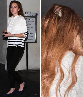 Lindsay-Lohan-Is-Losing-Her-Hair