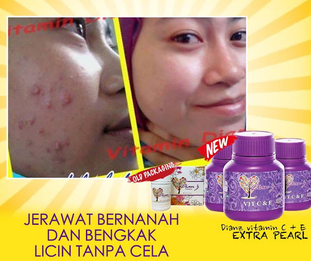 Dian Vitamin C & E Extra Pearl Murah (New Formula)