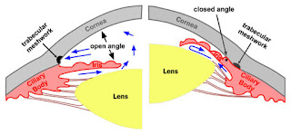 glaucoma open access journal