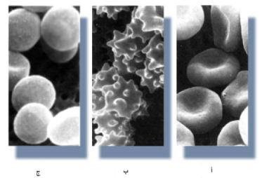 خلية دم حمراء موضوعة في أ) محلول متساوي التوتر، ب) محلول زائد التوتر، ج) محلول منخفض التوتر.