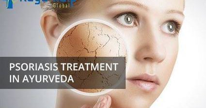 Psoriasis Specialist Treatment in Delhi NCR India