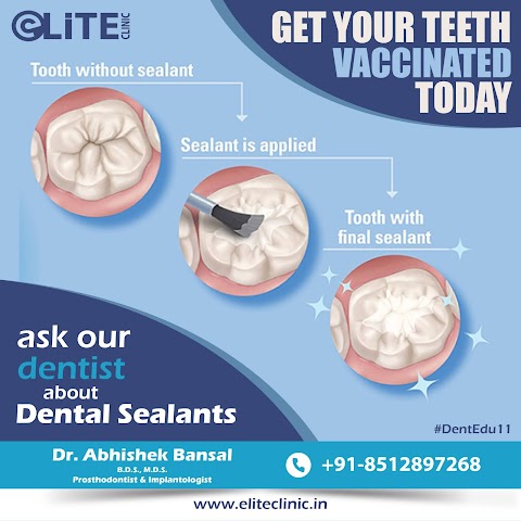 Dental Sealants - Social Media Post