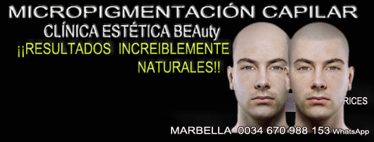 clinica estética, dermopigmentacion capilar Málaga o Marbella y maquillaje permanente en marbella