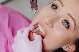 ooth sensitivity, causes of tooth sensitivity, symptoms of tooth sensitivity, treatment of tooth sensitivity, prevention of tooth sensitivity,Desensitizing toothpaste,Fluoride treatment,Gum grafting,Dental bonding,root canal dentist,