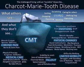 mon vécu avec la maladie de Charcot-Marie-Tooth