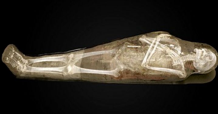 Swedish Museum exhibit allows visitors to virtually unwrap mummies
