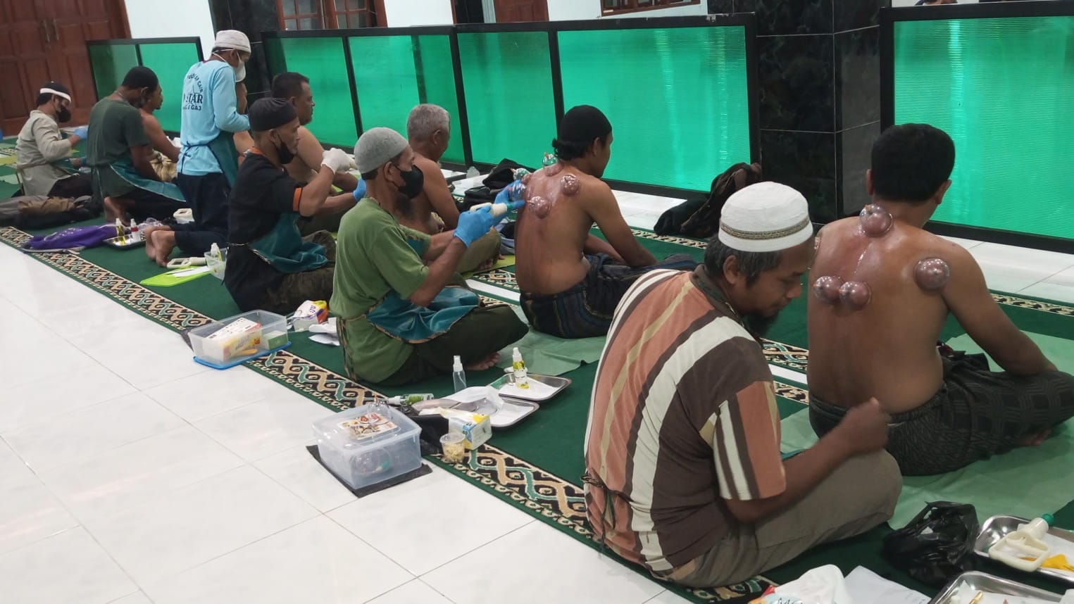 Terapi bekam