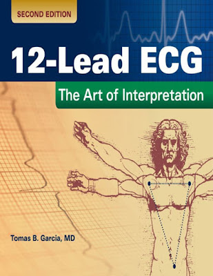 12-Lead ECG: The Art of Interpretation 2nd Edition