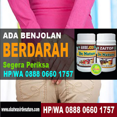 Obat Tradisional Berak Darah Segar 