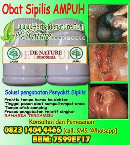 obat sipilis, obat penyakit sipilis, obat raja singa, obat penyakit raja singa, sipilis atau raja singa