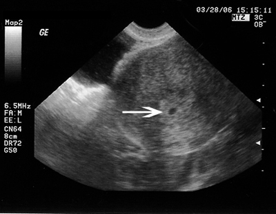 Pictures Of 8 Weeks Pregnant. 7 Weeks Pregnant