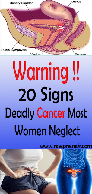 20 Deadly Cancer Signs Most Women Neglect