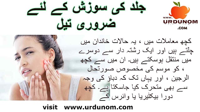 جلد کی سوزش کے لئے ضروری تیل | Health and Beauty in urdu