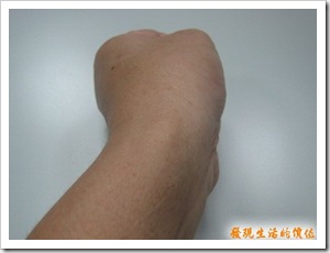 ganglion_after03