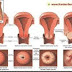 Cara Merapatkan Vagina Agar Lebih Menggigit Seperti Perawan Kembali