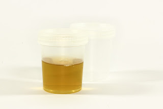 The colour of a healthy person urine