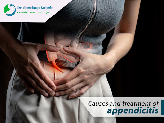 treatment of appendicitis