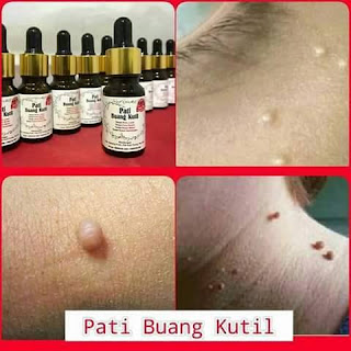 PATI BUANG KUTIL 