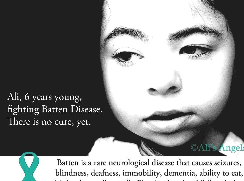 Batten Disease - Battens Disease Cure