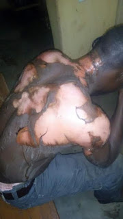 Angry wife pour boiling water on husband in Plateau State for marrying second wife